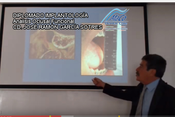 Diplomado Implantología Dr. Sotres