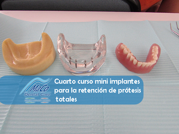 Curso Mini implantes 4