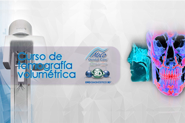 TOMOGRAFÍA VOLUMÉTRICA